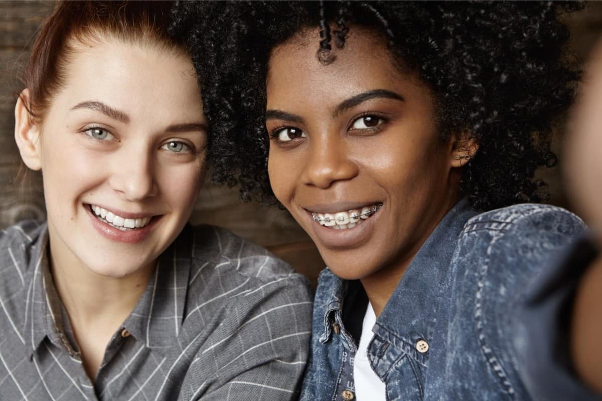 Dynaflex Norris Passive Self-Ligating Bracket System Now Exclusively at Seacoast Braces Miller Orthodontics in Dover and Exeter, NH